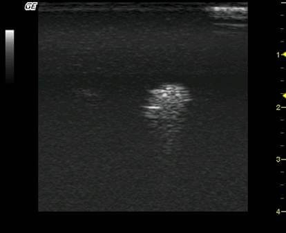 Gaumard S230.52超聲乳房模擬器,S230.52乳房超聲培訓(xùn)模體